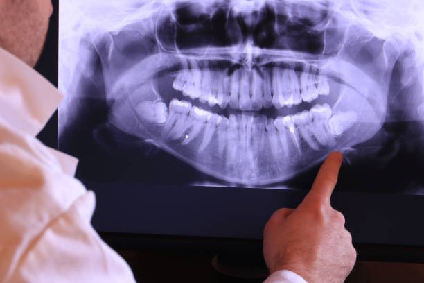 Best Broken or Cracked Tooth Emergency Dentist in Salmon Creek, WA