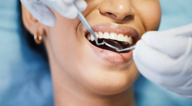 Best Emergency Dental Services for Seniors in Salmon Creek, WA