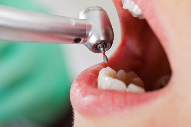 Best Emergency Dentist for Special Needs Patients in Salmon Creek, WA